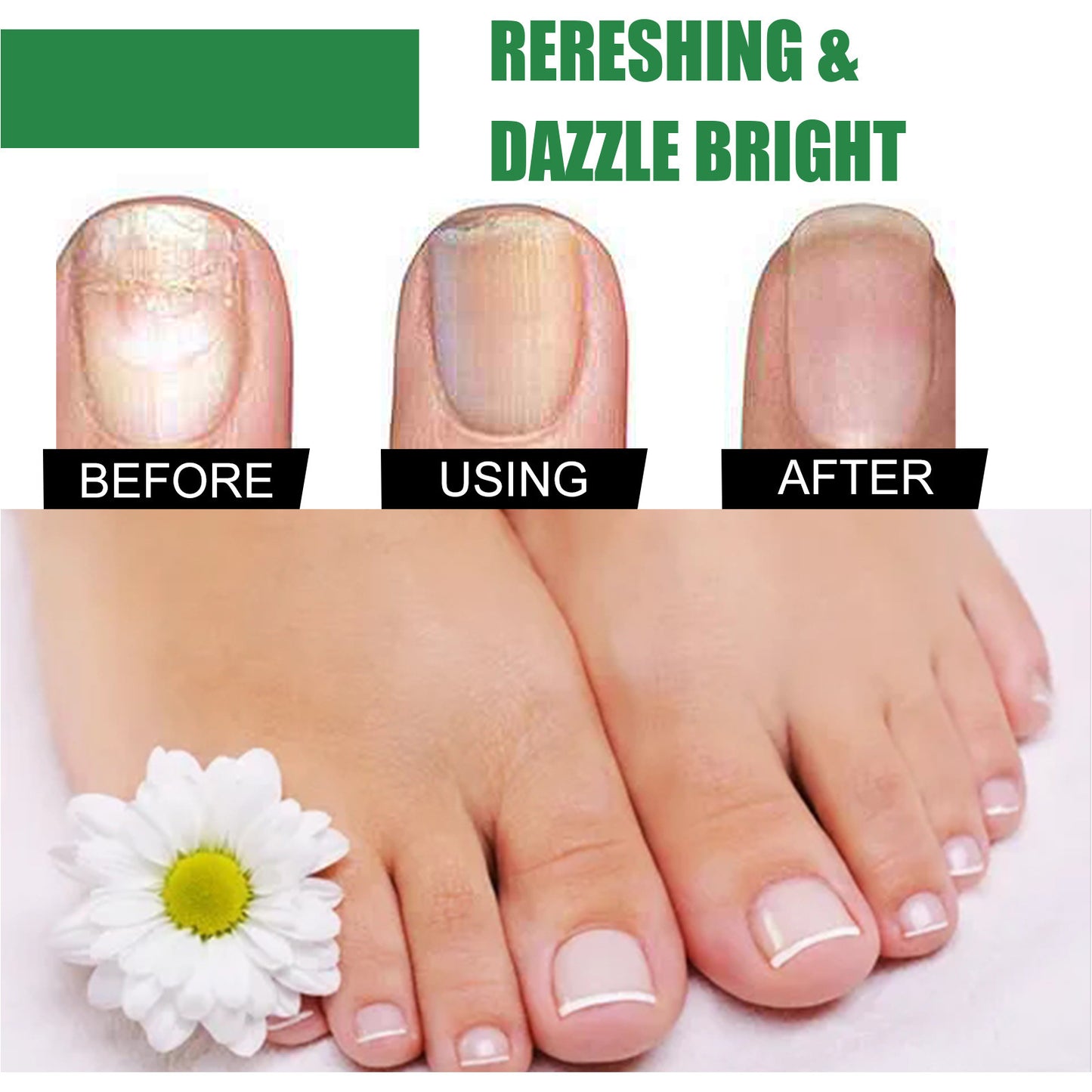 Foot Nail Tea Tree Oil