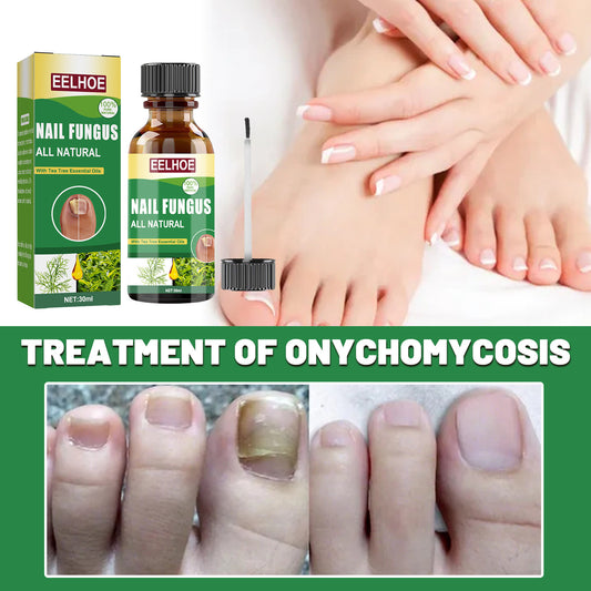 Foot Nail Tea Tree Oil