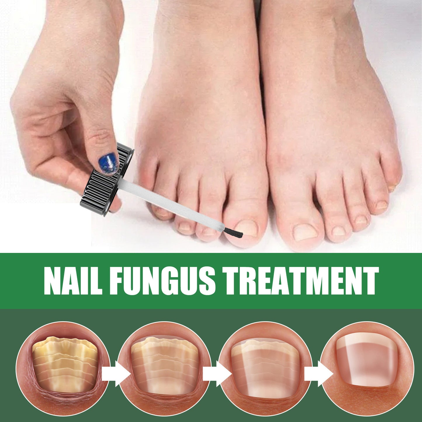Foot Nail Tea Tree Oil